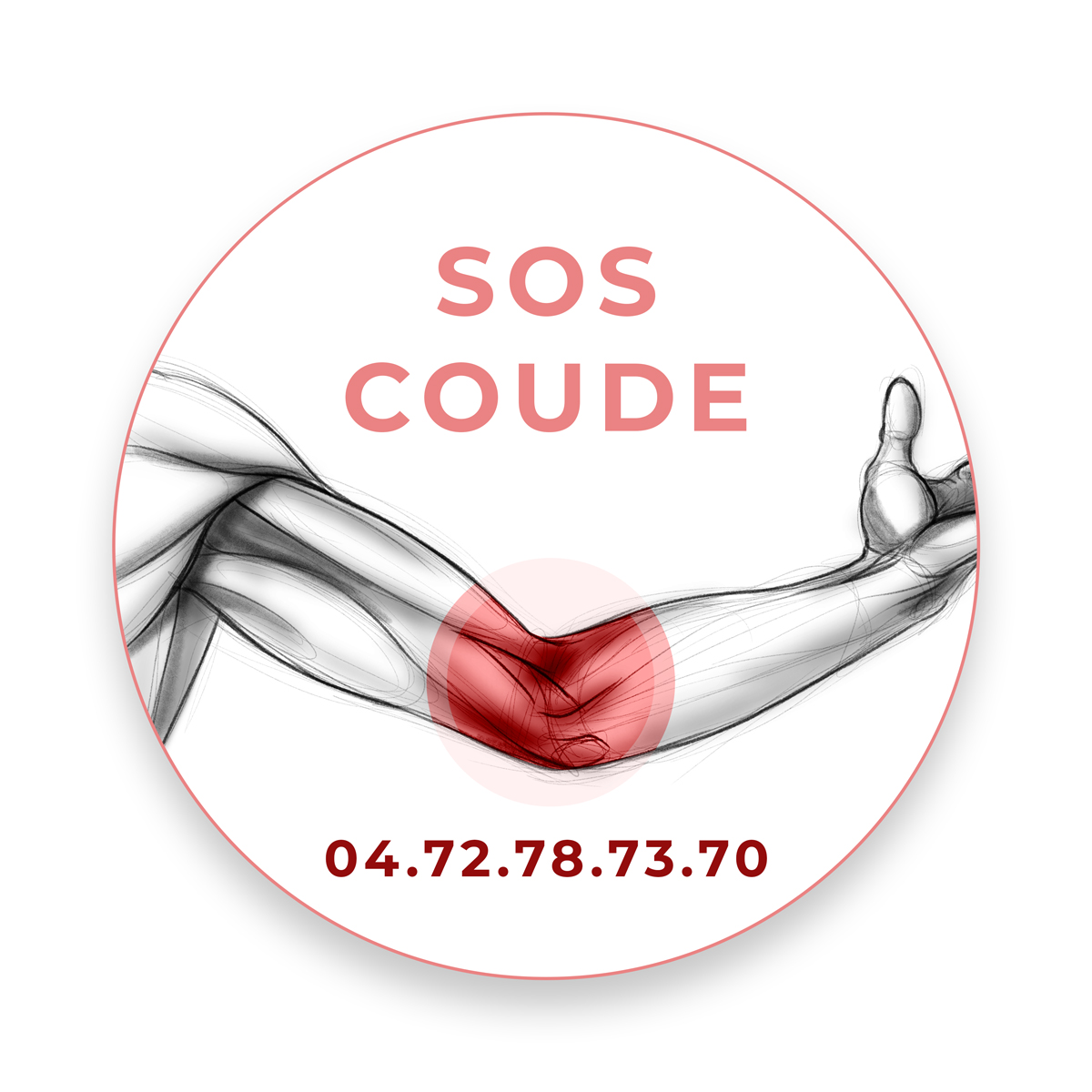 SOS Coude